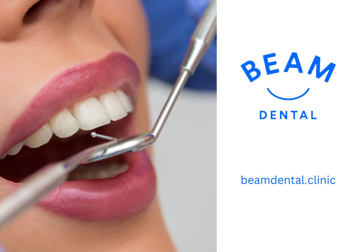 Dental Care at Beam Dental Clinic Your Premier Choice in Brent Cross Shopping Centre, London