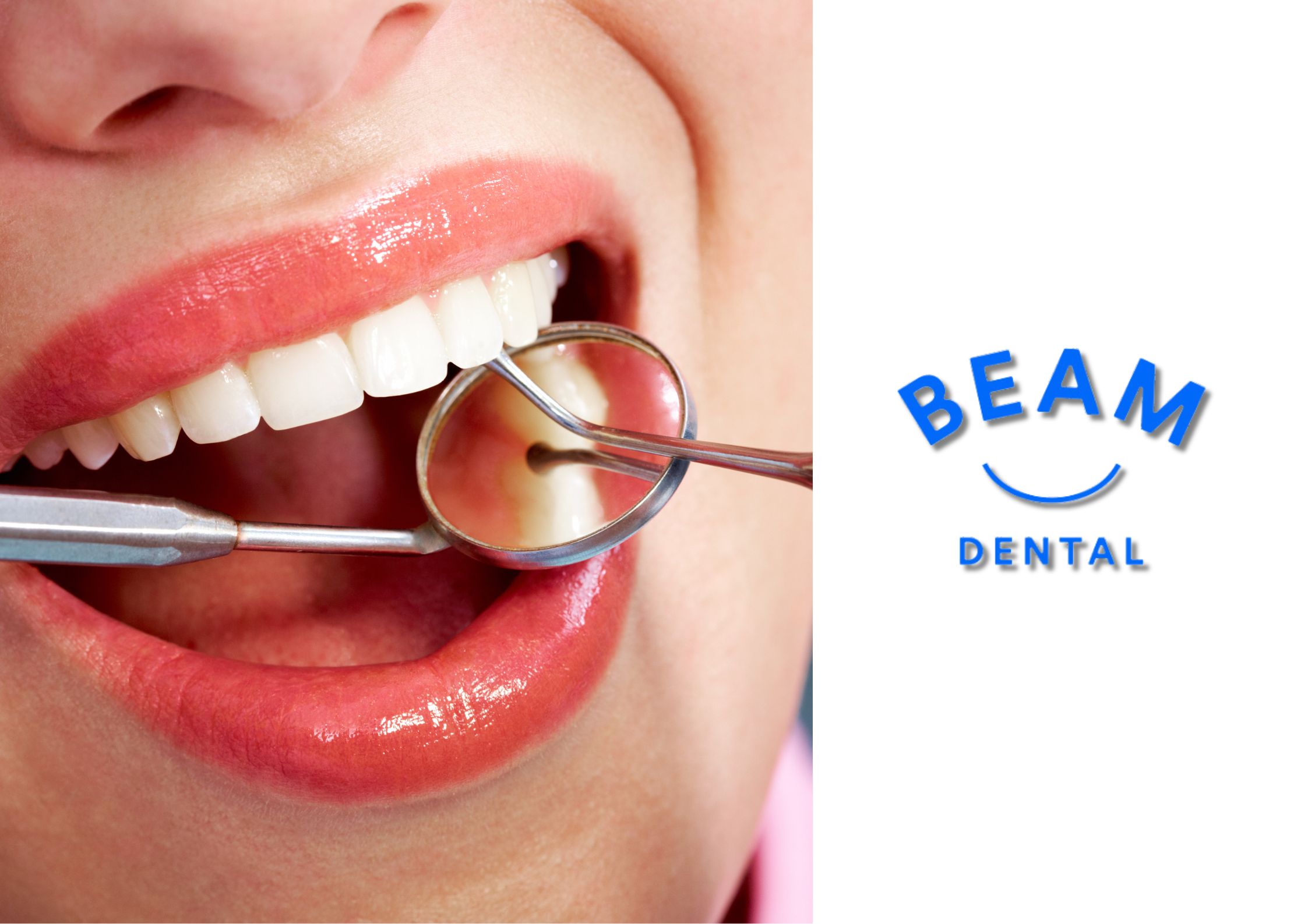 Dental hygienist carrying out a professional scale and polish at Beam Dental in Brent Cross