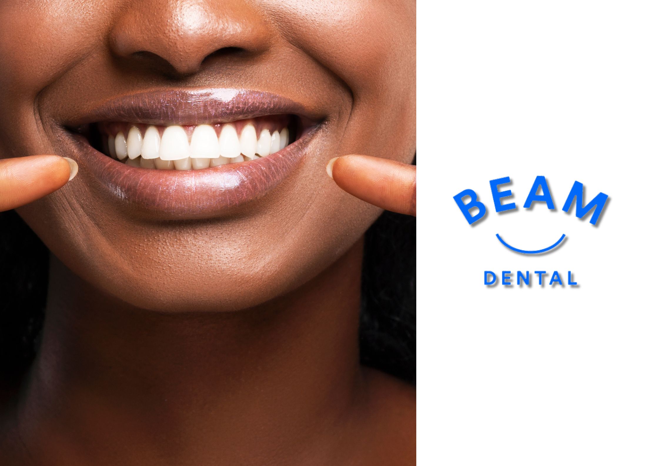 Composite Bonding vs Veneers_ Which Is Right for You