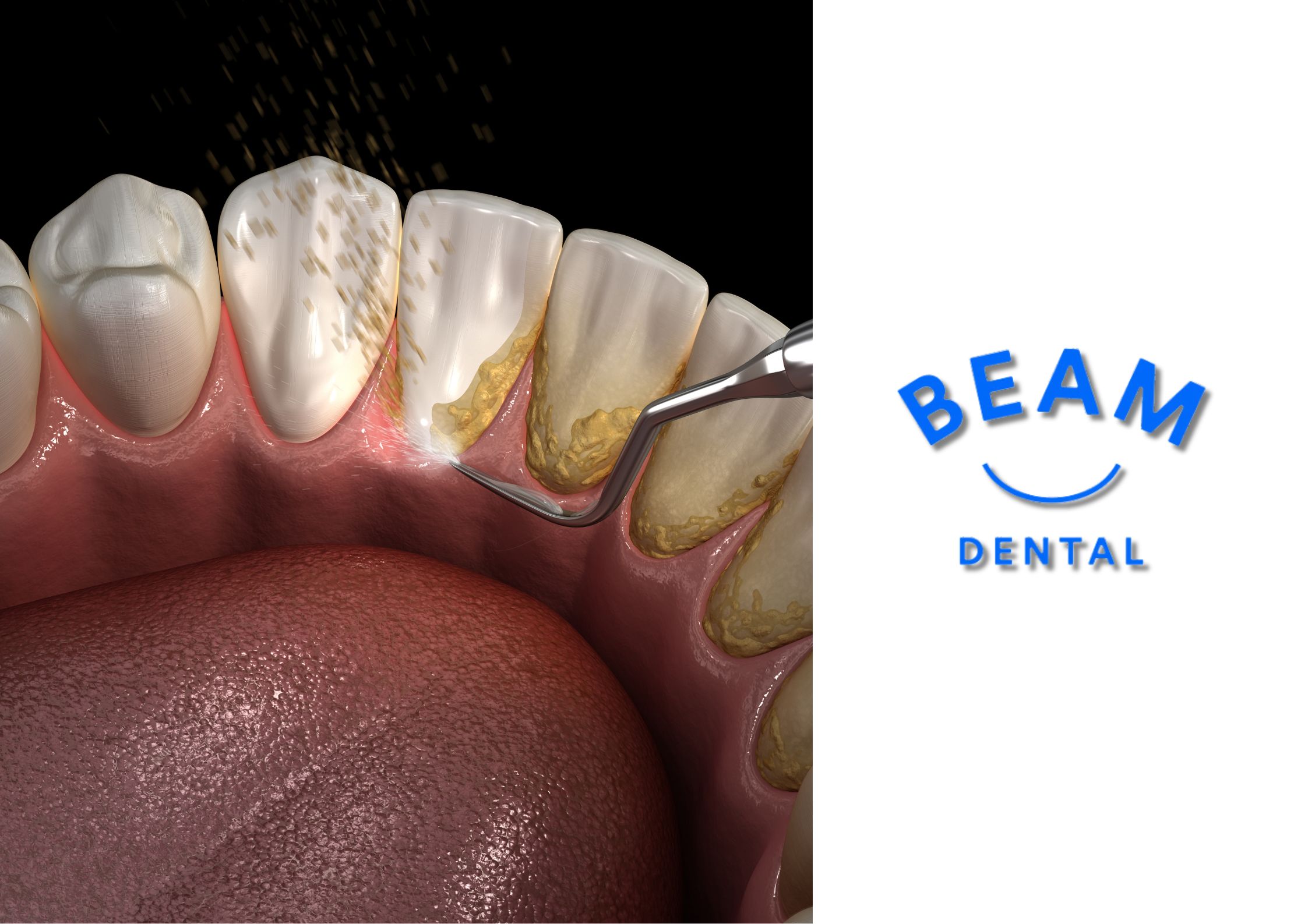 Dentist placing a natural-looking white filling on a patient’s tooth at a Brent Cross dental clinic