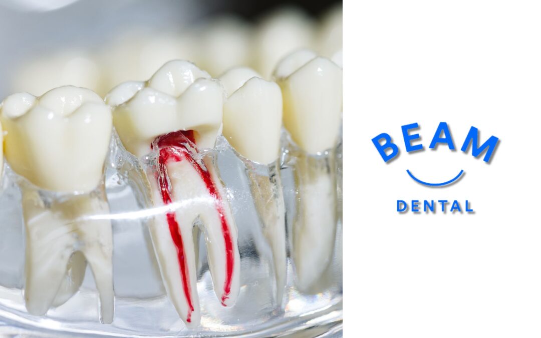 Signs You May Need a Root Canal and Why You Shouldn’t Delay