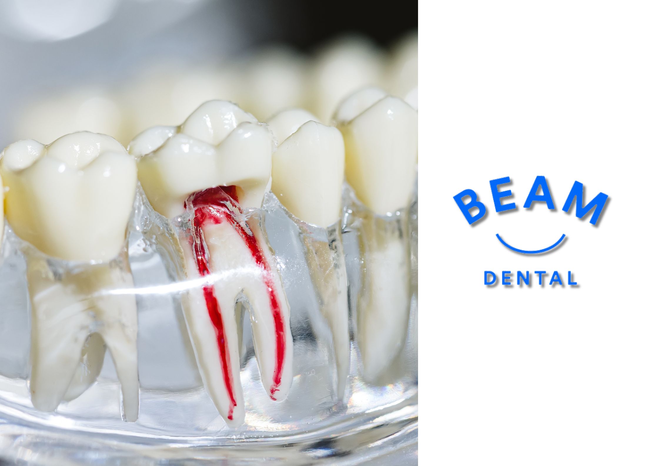 Signs You May Need a Root Canal and Why You Shouldn’t Delay