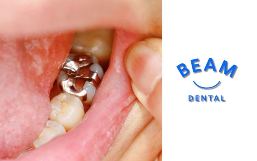 Restorative Dental Treatments in Brent Cross | Beam